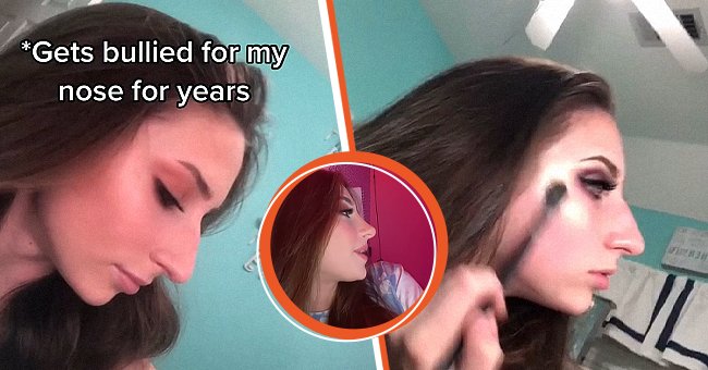 A teen that was bullied shows viewers her nose before and after surgery | Photo: TikTok/katycrooksmakeup 