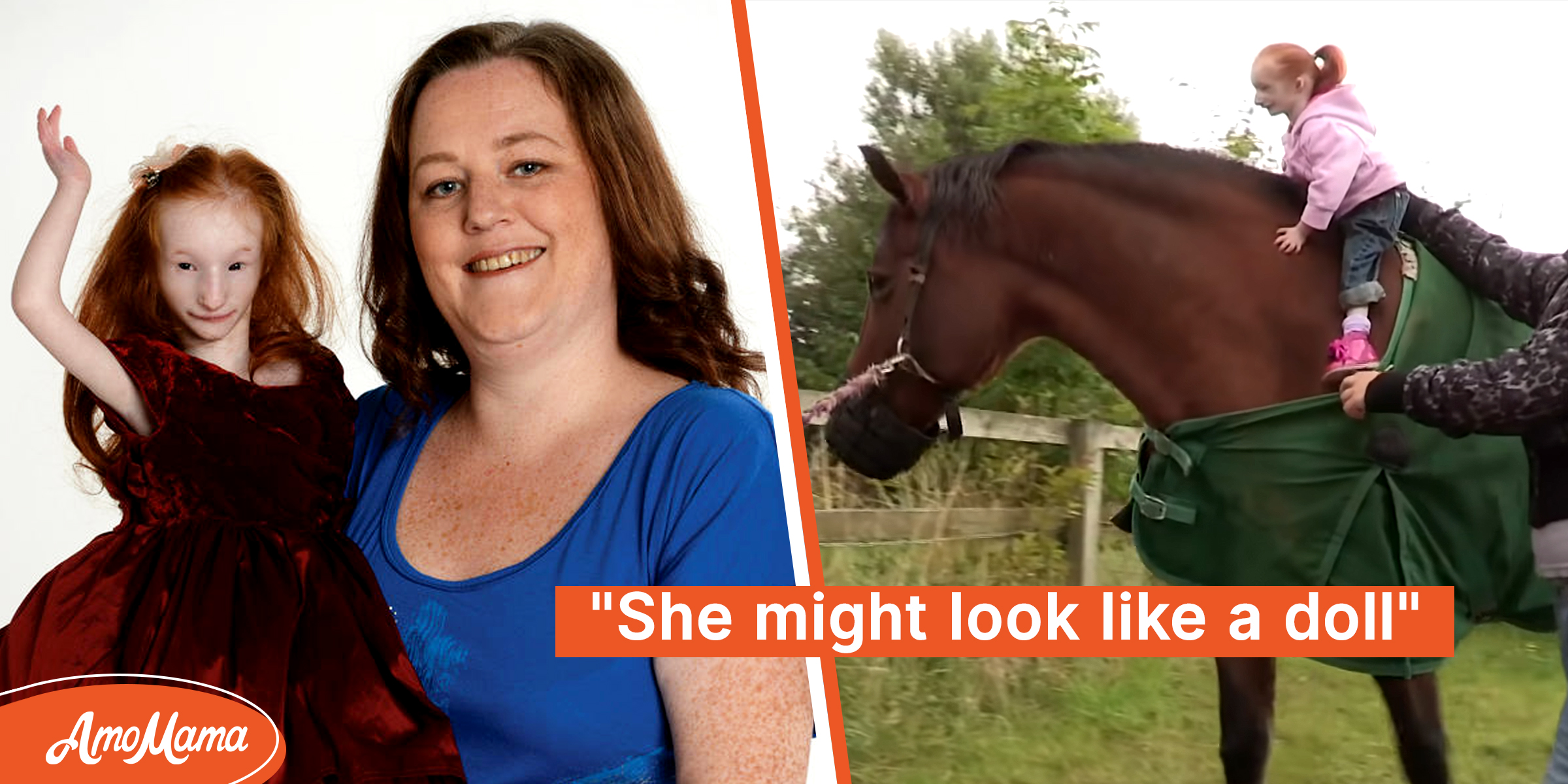 World’s Smallest Baby Girl Is Now 15– She Has Grown & Looks ‘So Pretty’ despite Doctors’ Predictions