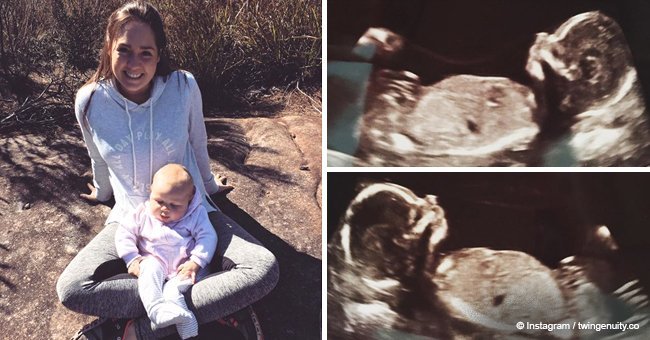 6 weeks after mom gave birth to baby girl, scans revealed she was pregnant with twins