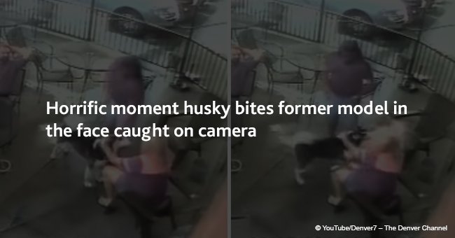 Horrific moment husky bites former model in the face caught on camera