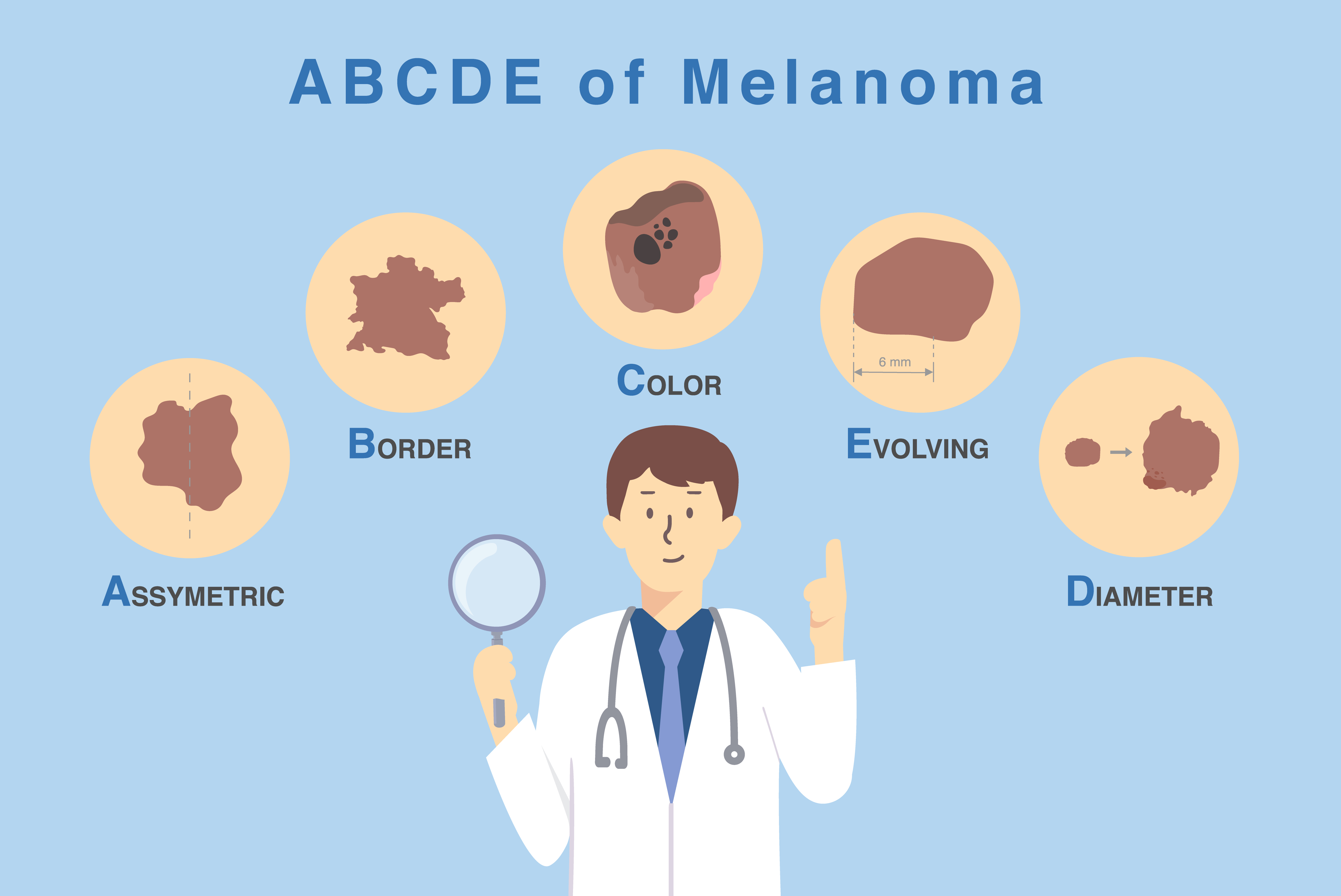 Doctor holding a magnifying glass over five key characteristics of skin damage, demonstrating the ABCDE method for diagnosing and classifying melanoma | Source: Getty Images