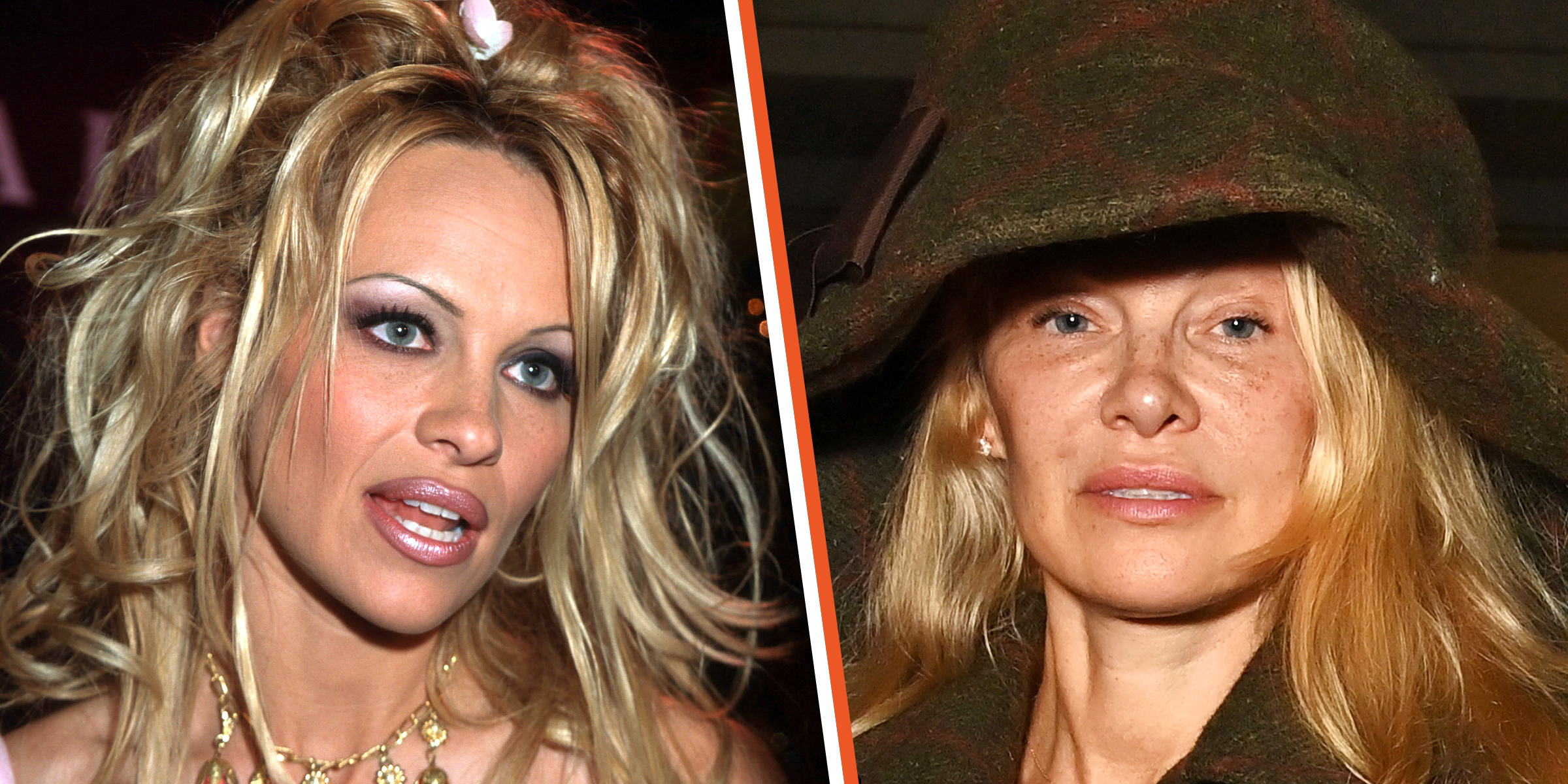 Pamela Anderson, 1999 | Pamela Anderson, 2023 | Source: Getty Images