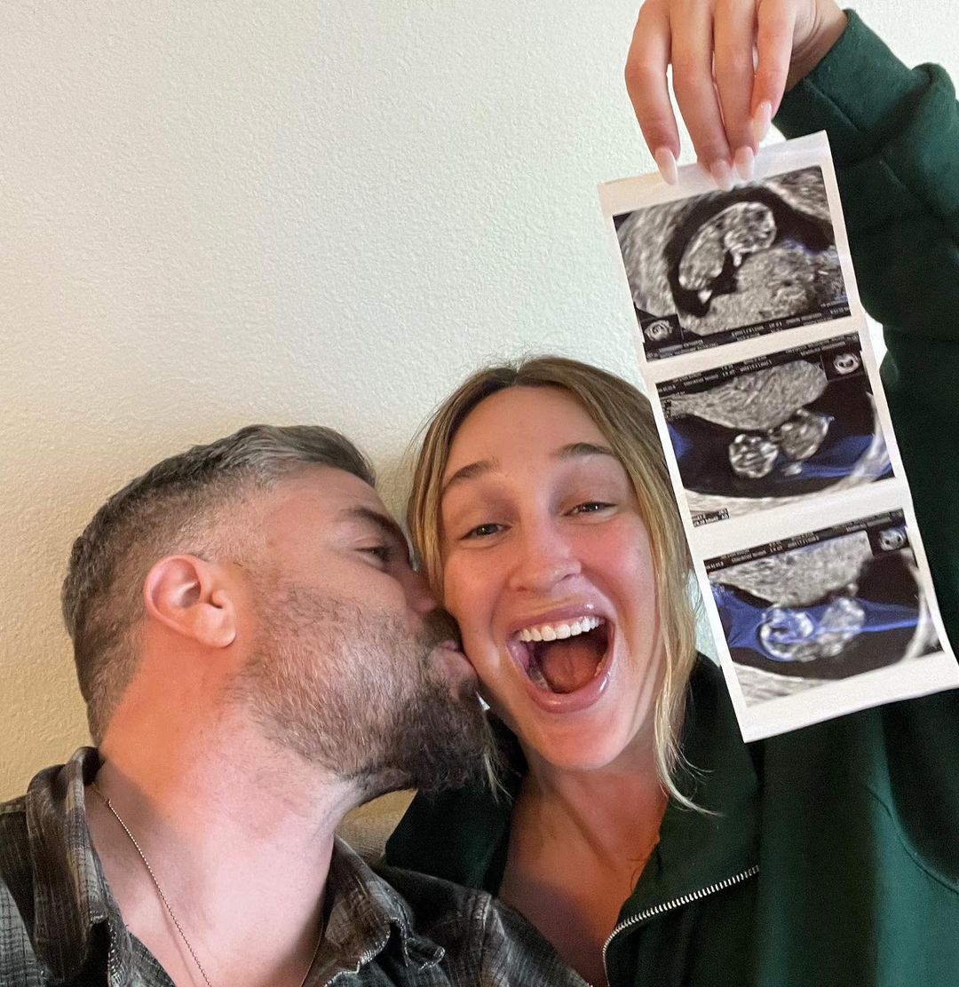 Jackie Miller James and her husband with a scan of their baby | Source: Instagram.com/jaxandrose/