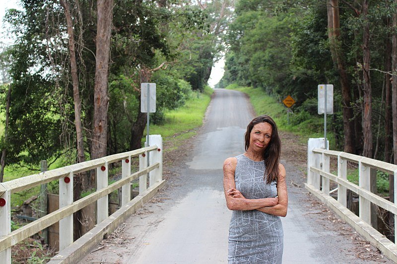 Turia Pitt, January 12, 2018. | Source: Wikimedia Commons