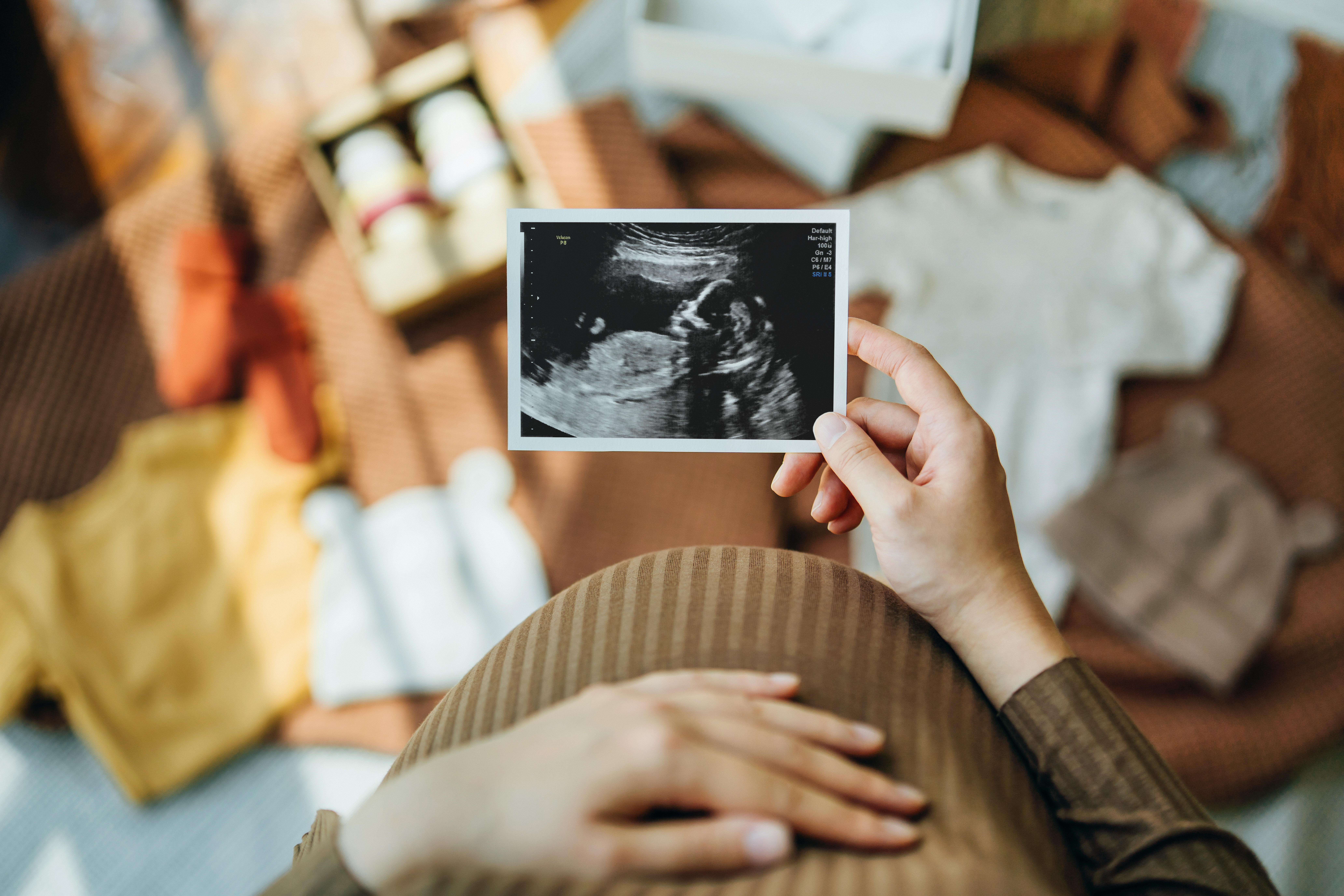 Embarazada mirando una imagen de ultrasonido | Foto: Getty Images