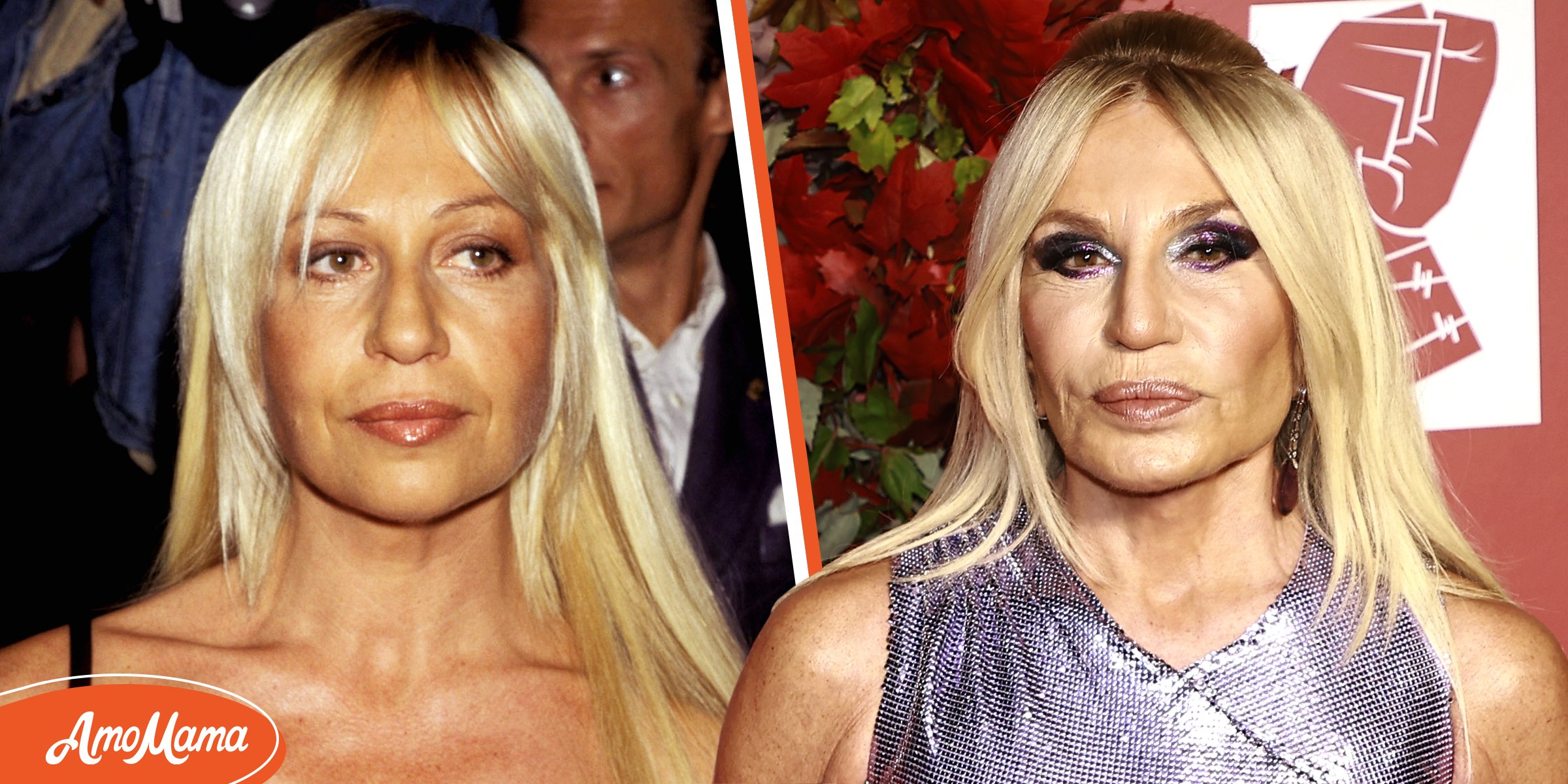 Experts Believe Donatella Versace Had Several Plastic Surgeries & She