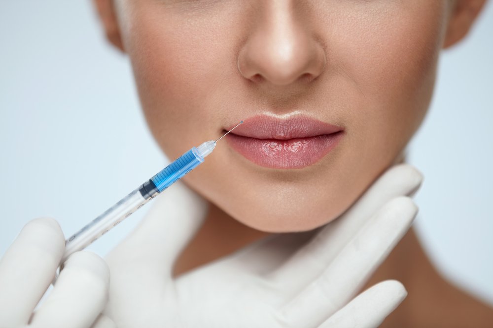 Lip Augmentation on Young Woman. | Photo: GettyImages