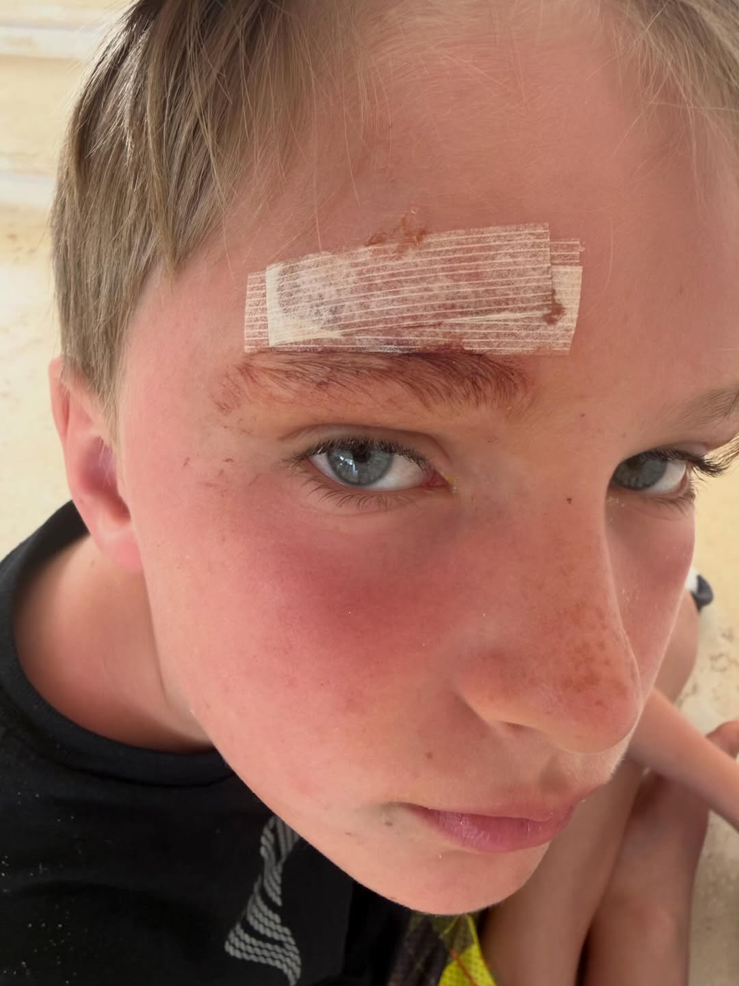 Leo Baldwin showing off his bandaged injury | Source: Instagram/hilariabaldwin | alecbaldwininsta