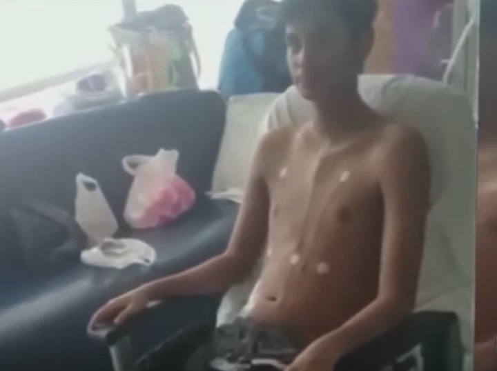 Benis, joven paciente en el hospital | Foto: YouTube/Primer Impacto Benis, joven paciente en el hospital | Foto: YouTube/Primer Impacto