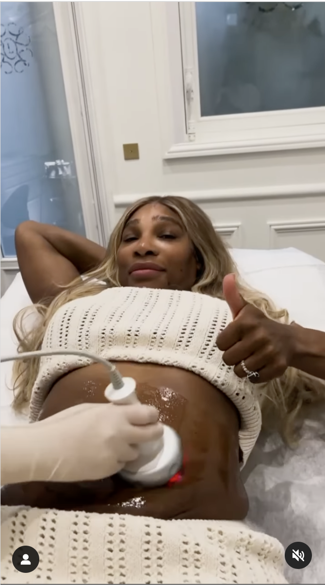 Serena Williams undergoing a tummy tightening procedure, as seen in a video dated June 15, 2024 | Source: Instagram/serenawilliams