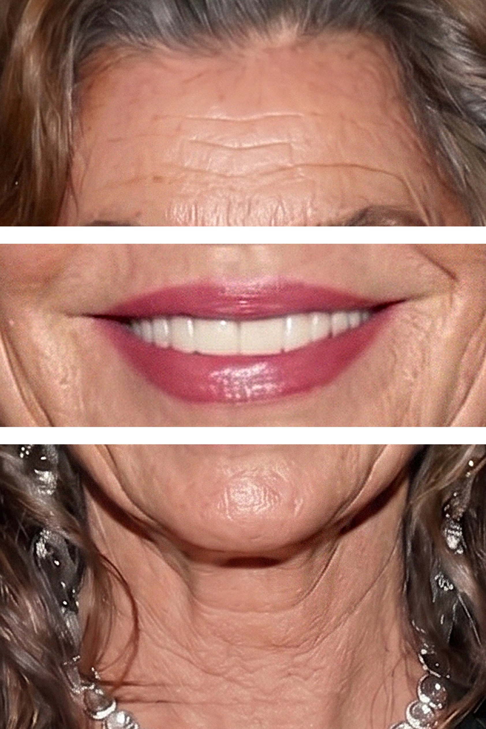 Focusing on specific facial zones, this AI-edited composite graphic highlights hyper-detailed forehead wrinkles, natural smile lines around the mouth, and delicate neck folds. | Source: Gemini