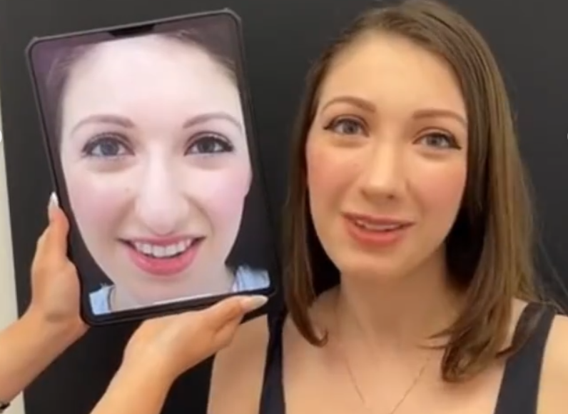 Persian patient before and after rhinoplasty, dated June 21, 2022 | Source: Instagram/drkassir