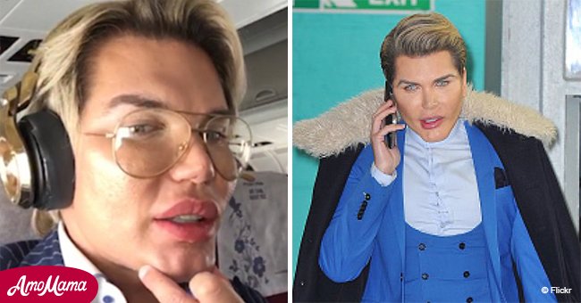 Human Ken Doll shows off tiny waist after rib removal 