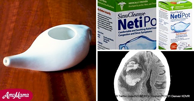 69-year-old woman dies from brain-eating amoeba after using neti pot with tap water