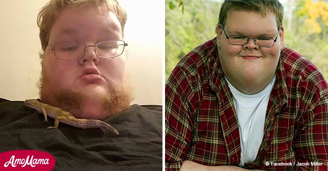 15-year-old weighed 707 pounds but drops five shirt sizes after surgery