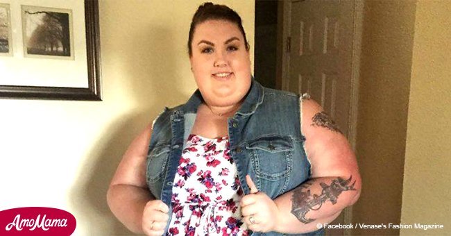 Woman loses over 170 pounds. Her body and face dramatically change