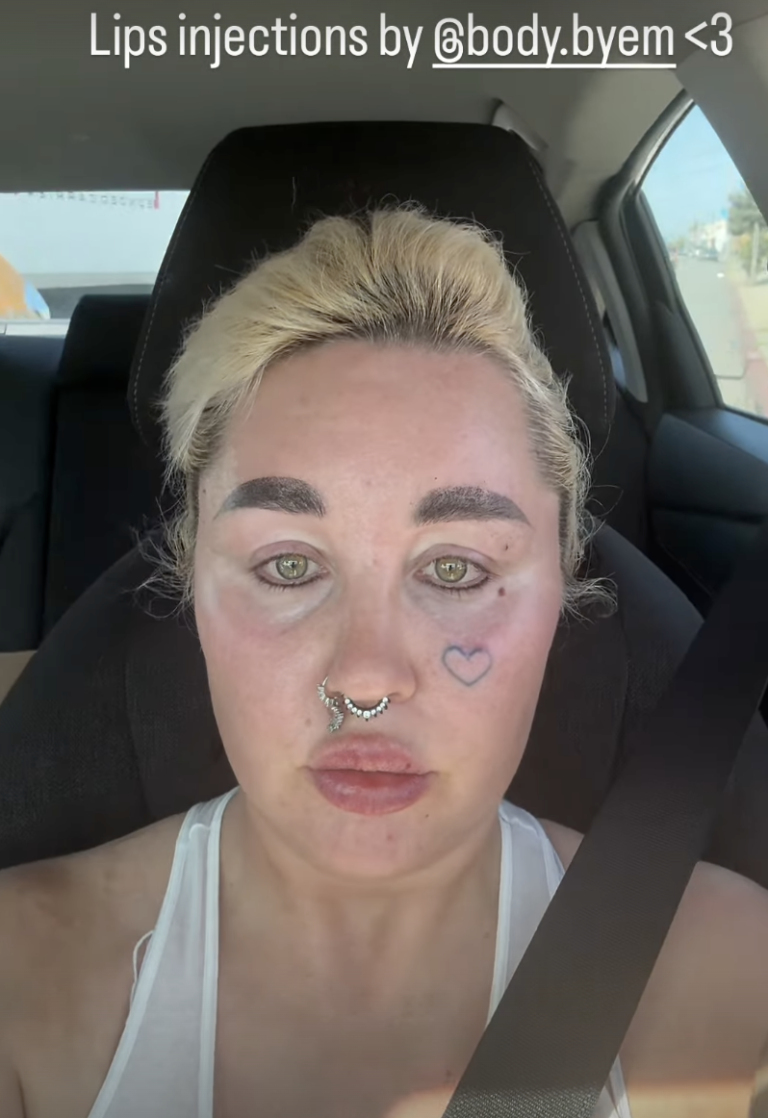 Captured during a car selfie, Amanda Bynes reveals her lip filler look and facial piercings, offering an unfiltered snapshot of her style evolution and personal expression. | Source: Instagram/amandapandapandapanda1