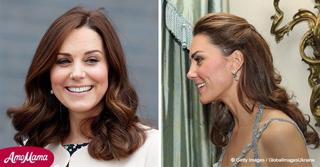 Daily Mail: Here's the reason behind the scar on Kate Middleton's head