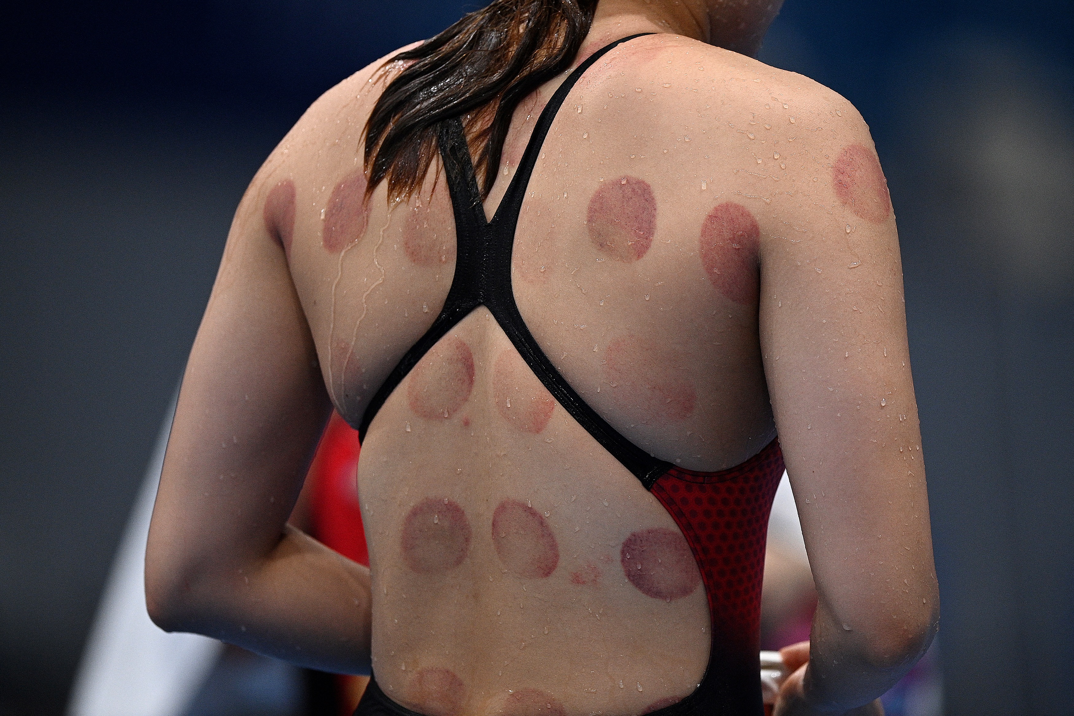 Marks are pictured on the back of a swimmer ahead of a swimming event during the Tokyo 2020 Olympic Games in Tokyo on August 1, 2021. | Source: Getty Images