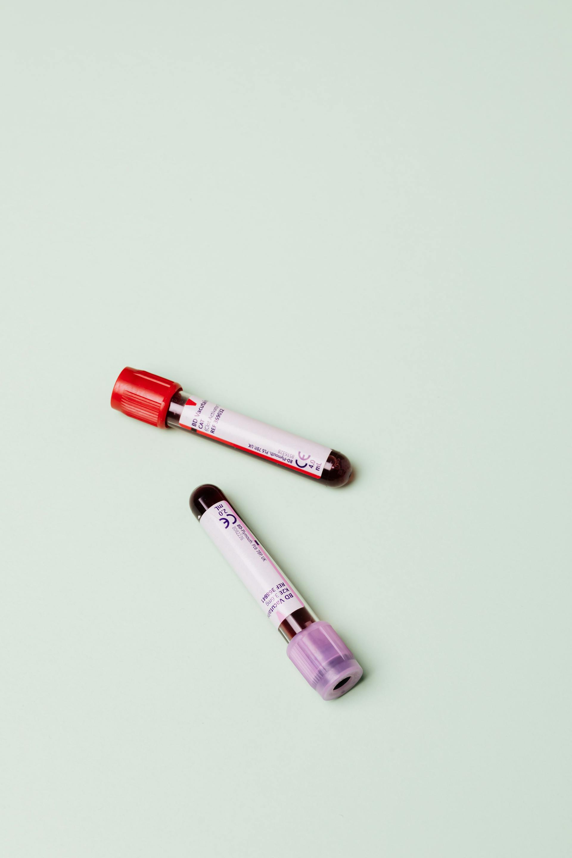 Two vials of blood | Source: Pexels