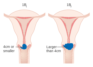 Source: Commons Wikimedia Source: Commons Wikimedia