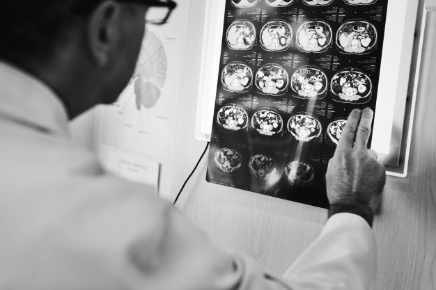 Brain scans. I Image: Freepik. Brain scans. I Image: Freepik.