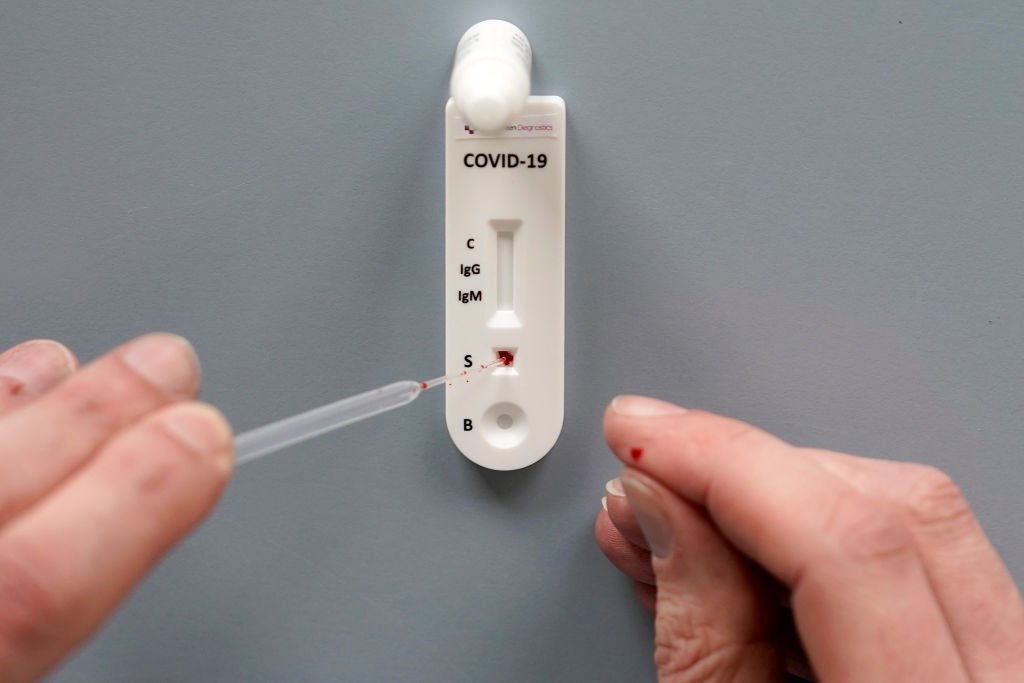 Test Covid-19. | Photo : Getty Images