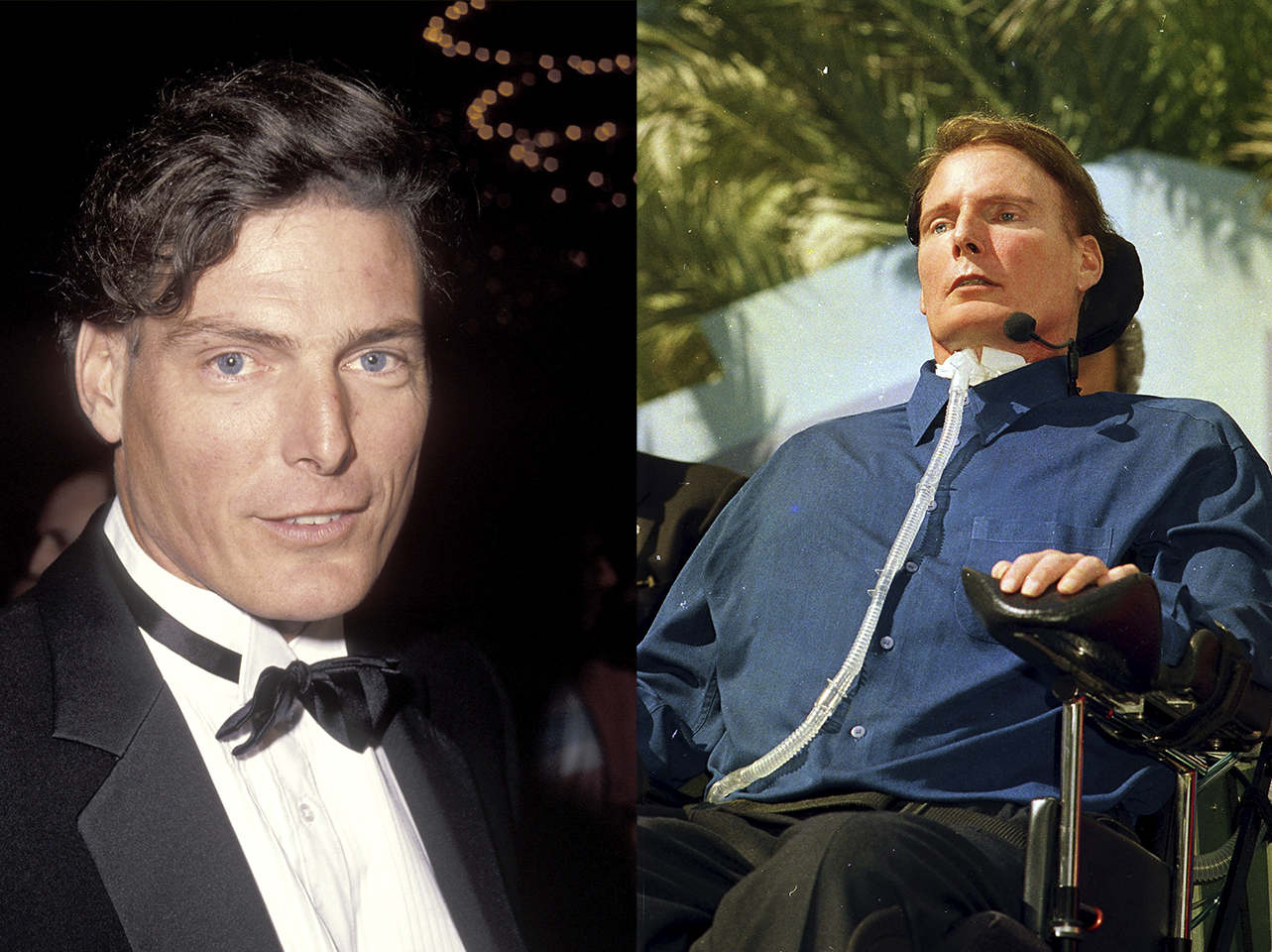 Christopher Reeve on July 19, 1991 | Christopher Reeve on October 26, 2000 | Source: Getty Images