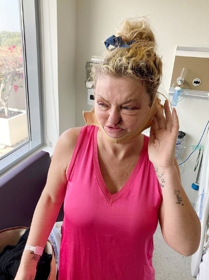Inside the hospital, Danniella Westbrook wears a facial compression strap as she heals and recovers from extensive reconstructive procedures. | Source: X/DailyMailUK