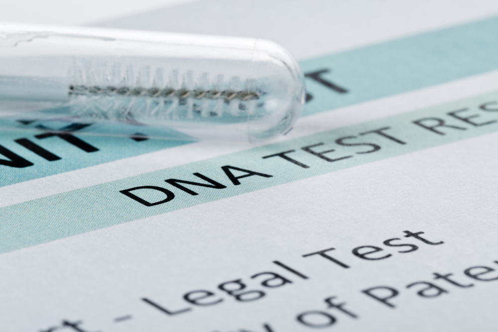 DNA test result | Shutterstock