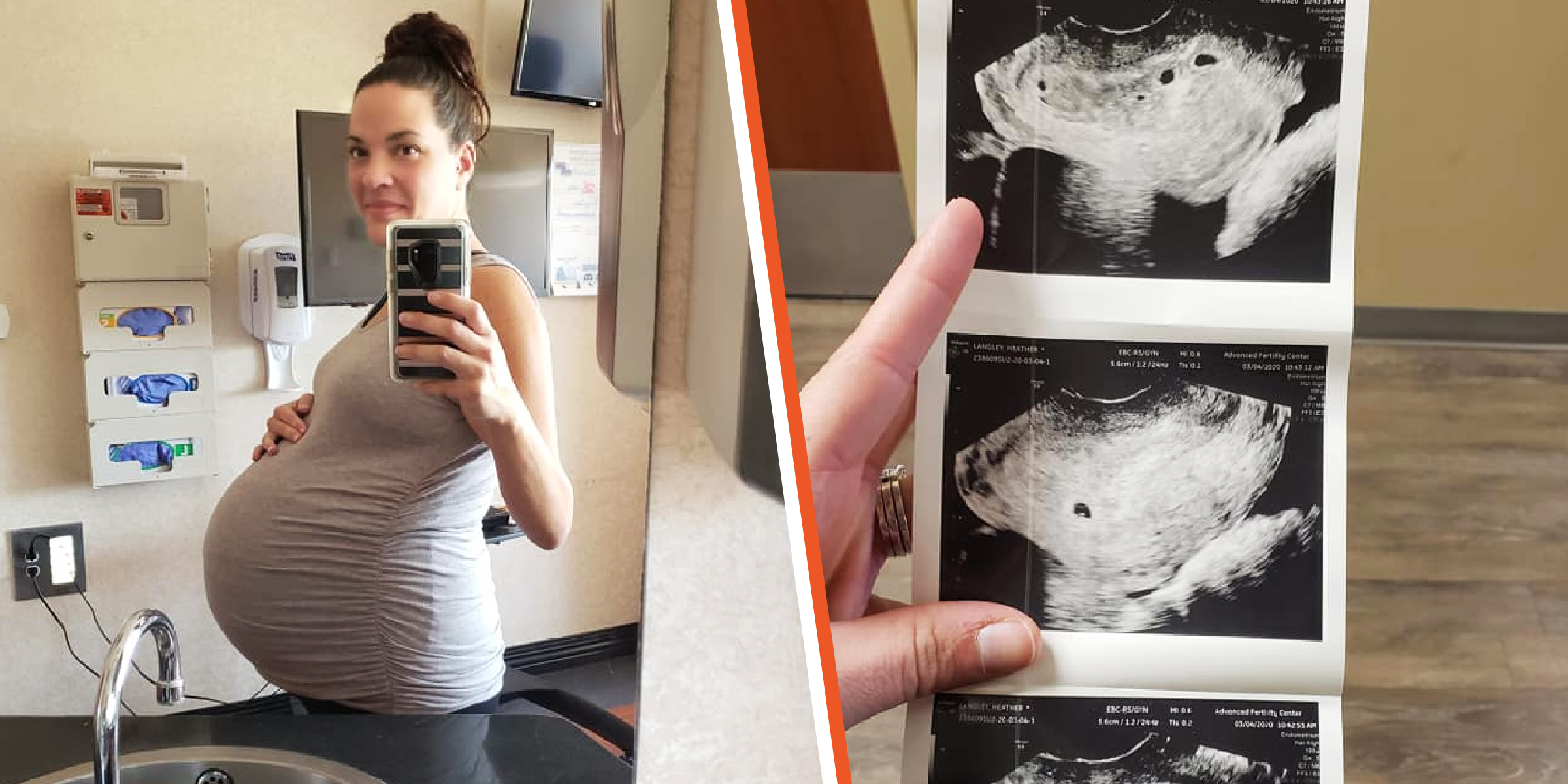 Heather Langley | The ultrasound scan | Source: facebook.com/HLangley03