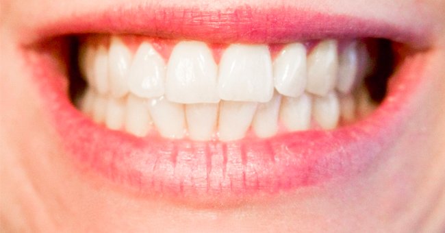 An image of a lady's teeth | Photo: Pxhere