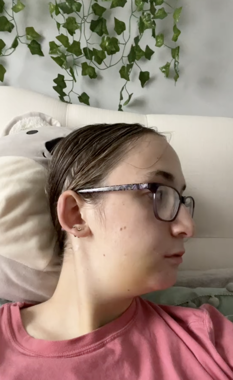 A screenshot of Maddie healing after undergoing double jaw surgery from a post dated October 24, 2023. | Source: TikTok/maddieakamofo