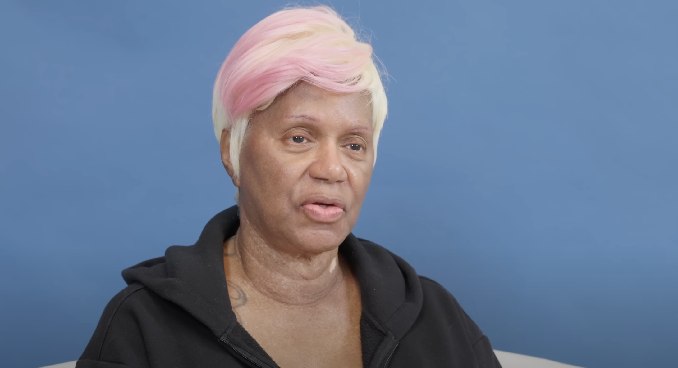 Diana as seen before surgery, dated August 23, 2024 | Source: YouTube/@Dr.Truesdale