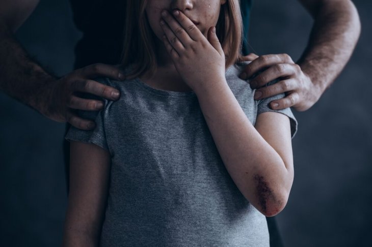 Une jeune fille blessée et effrayée. l Source: Shutterstock Une jeune fille blessée et effrayée. l Source: Shutterstock
