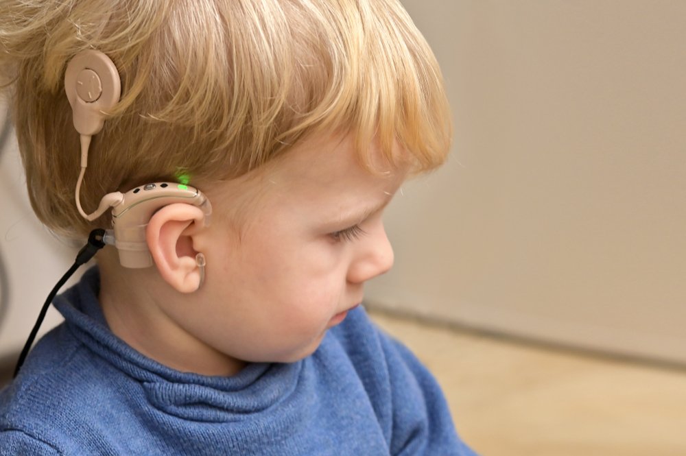 Niño con un aparato de audición. | Foto: Shutterstock
