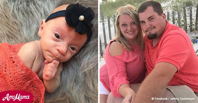 Baby girl born weighing just 14.5 ounces with 20% chance of survival is doing well