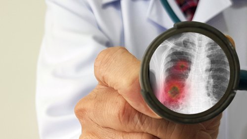 Médico con lupa mostrando el coronavirus. | Foto: Shutterstock