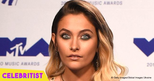 Paris Jackson reveals she underwent surgery for golf ball-sized abscess