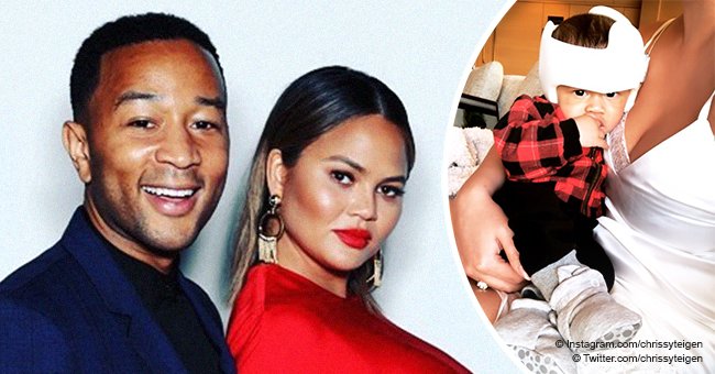 Chrissy Teigen reveals son Miles has to wear helmet due to his ...