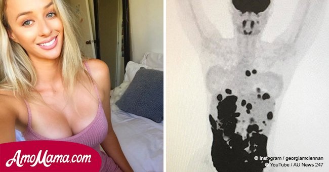 Smiling and healthy woman felt stabbing chest pain, receives shocking scan