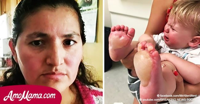 Mom notices her baby has blisters on her feet. She's horryfied to find out the truth