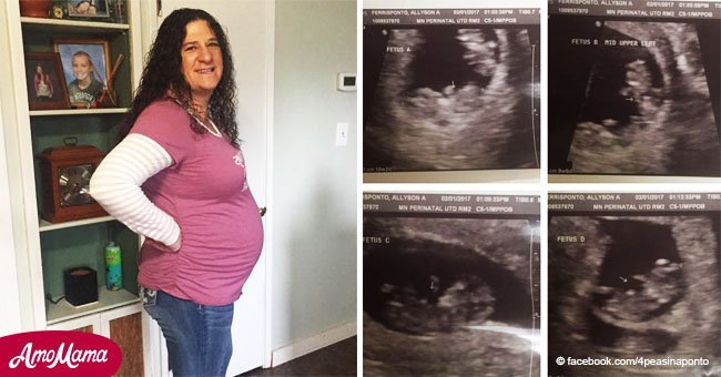 Woman devastated after 4 miscarriages. Doctor looks at ultrasound and finds more than one baby