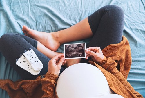 Mujer embarazada mirando una ecografía. | Foto: Shutterstock