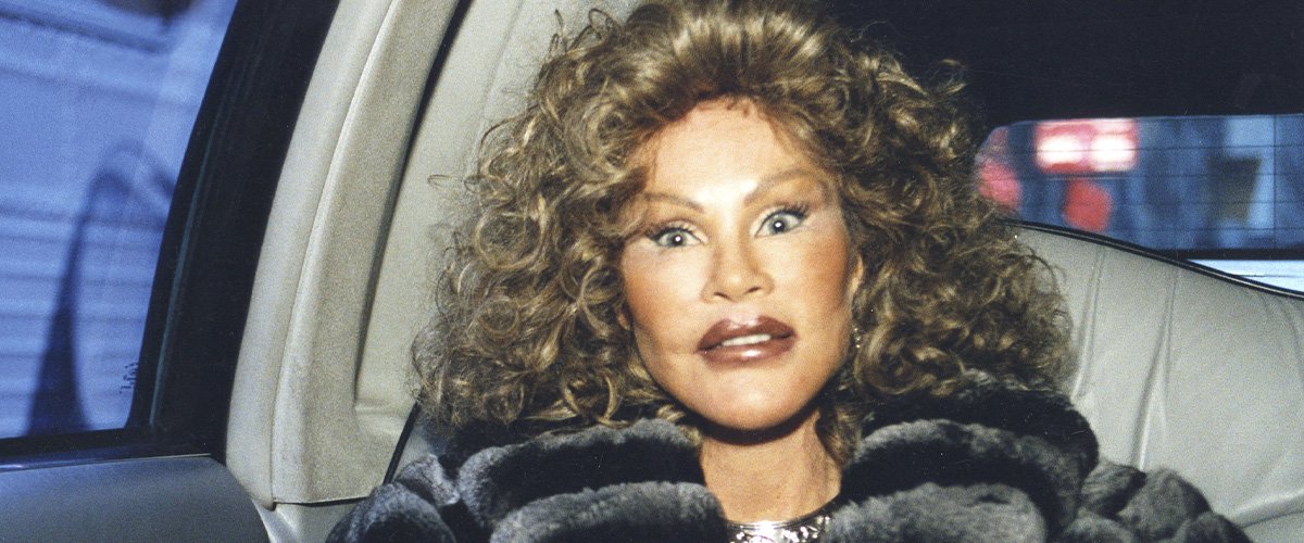 Catwoman Jocelyn Wildenstein Denies Cosmetic Surgery Interventions In
