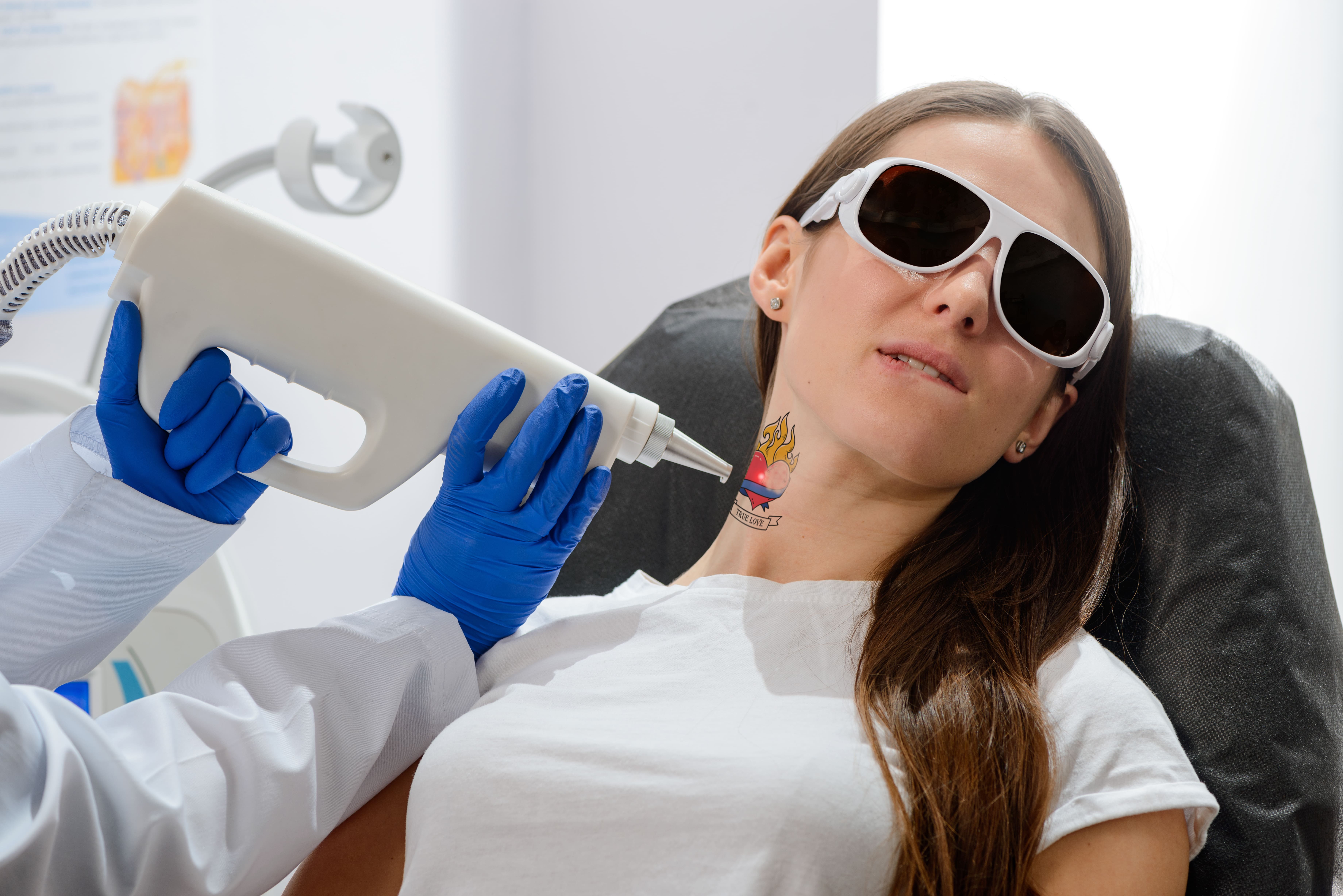 Tattoo Removal | Shutterstock