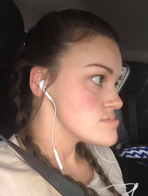 A side view of Katie Wolferding's jawline, dated June 2019 | Source: Facebook/katiewolferding