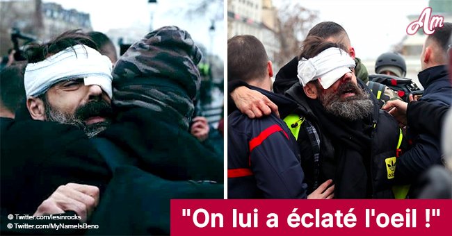 Jérôme, un Gilet Jaune, blessé à la tête par un projectile en direct (Vidéo)