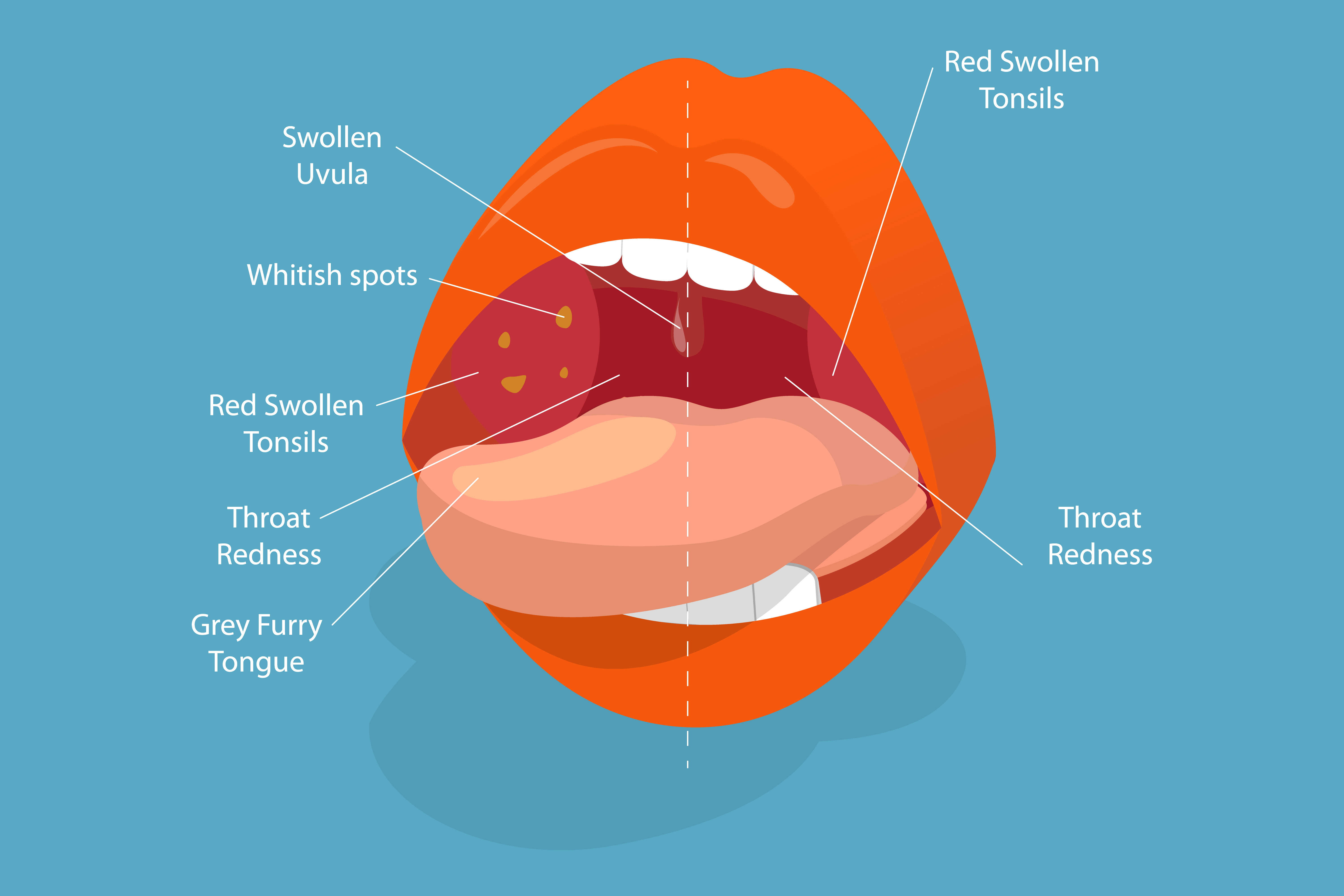 3D isometric flat vector conceptual illustration of parts of the human mouth | Source: Getty images