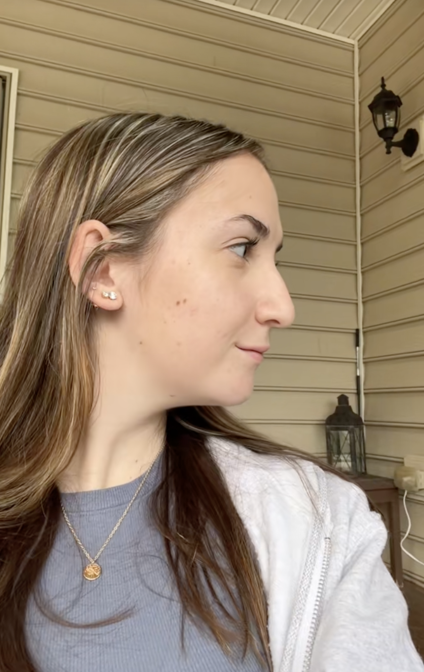 Maddie after undergoing double jaw surgery from a post dated August 2, 2023. | Source: TikTok/maddieakamofo